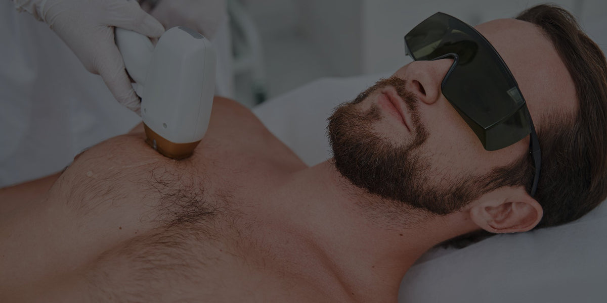 Epilazione laser uomo