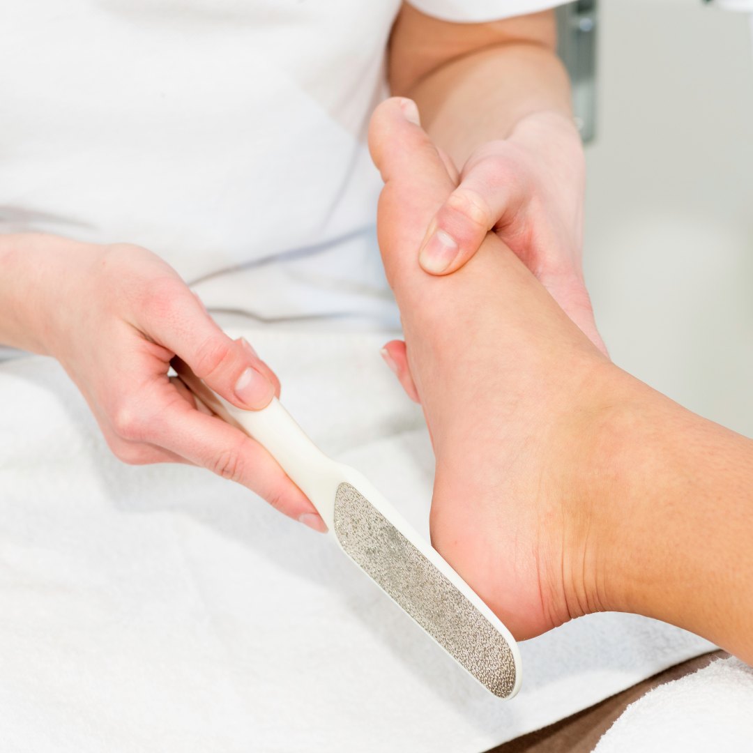 Pedicure curativo